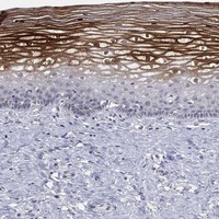 Immunohistochemical staining of human cervix, uterine shows strong positivity in squamous epithelial cells.