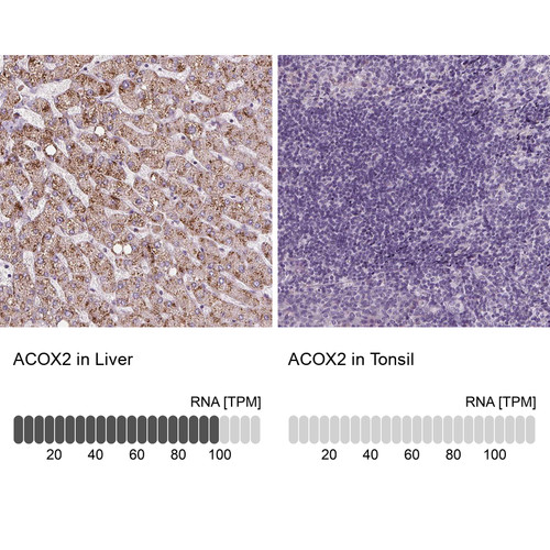 Immunohistochemistry analysis in human liver and tonsil tissues using HPA064845 antibody. Corresponding ACOX2 RNA-seq data are presented for the same tissues.