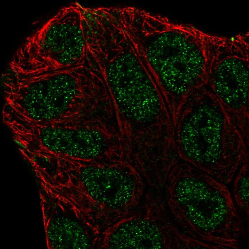 Immunofluorescent staining of human cell line RT4 shows localization to nucleoplasm.