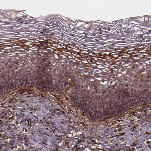 Immunohistochemical staining of human Cervix shows moderate cytoplasmic and membranous positivity in squamous epithelial cells.