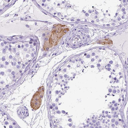 Immunohistochemical staining of human testis shows moderate cytoplasmic positivity in Leydig cells.