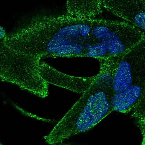 Immunofluorescent staining of human cell line RH-30 shows localization to nucleoplasm & plasma membrane.