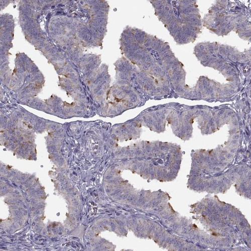Immunohistochemical staining of human fallopian tube shows strong positivity in cilia of glandular cells.
