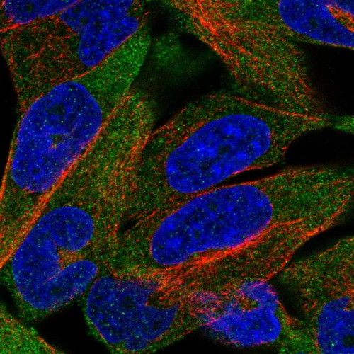 Immunofluorescent staining of human cell line RH-30 shows localization to plasma membrane.