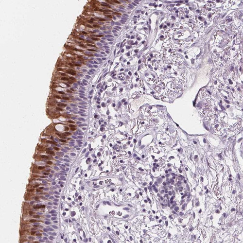 Immunohistochemical staining of human bronchus shows strong cytoplasmic and nuclear positivity in respiratory epithelial cells.