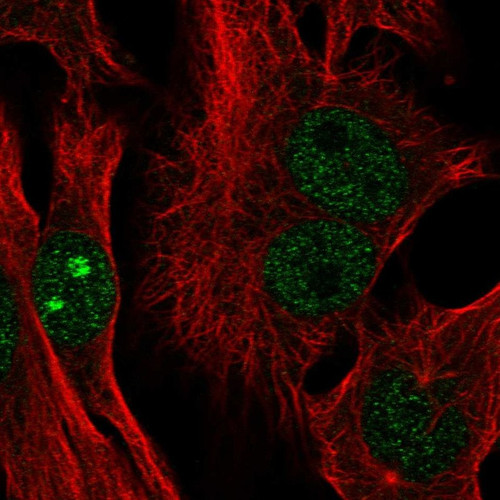 Immunofluorescent staining of human cell line SK-MEL-30 shows localization to nucleus & nucleoli.