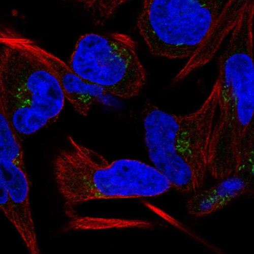 Immunofluorescent staining of human cell line RH-30 shows localization to the Golgi apparatus.