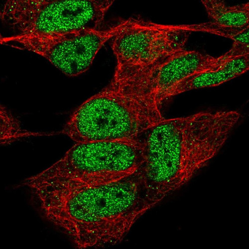 Immunofluorescent staining of human cell line SH-SY5Y shows localization to nucleoplasm & vesicles.