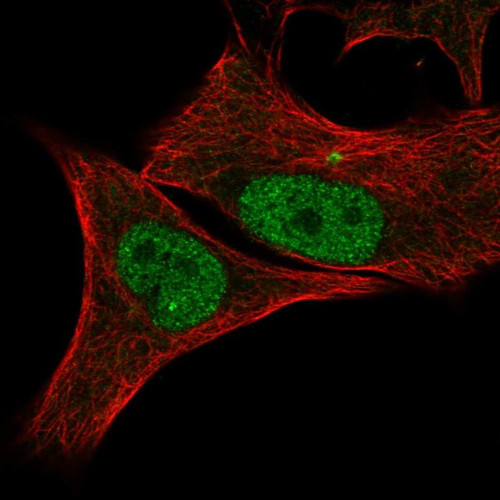 Immunofluorescent staining of human cell line SK-MEL-30 shows localization to nucleoplasm & centrosome.