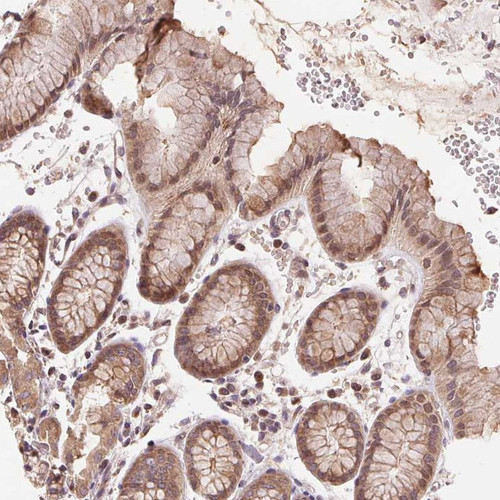 Immunohistochemical staining of human stomach shows moderate cytoplasmic and nuclear positivity in glandular cells.