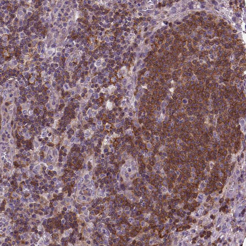 Immunohistochemical staining of human lymph node shows strong granular cytoplasmic positivity in non-germinal center cells.