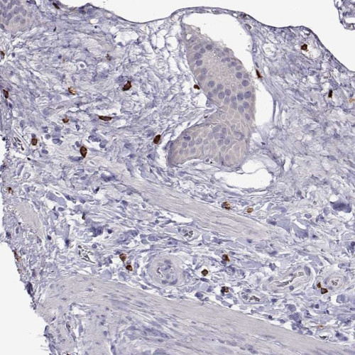 Immunohistochemical staining of human gallbladder shows strong positivity in a subset of leukocytes.