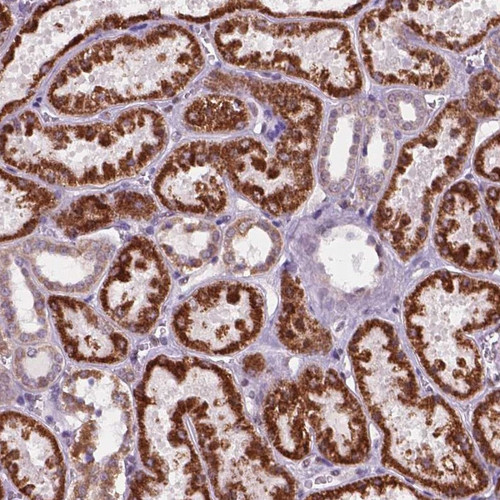 Immunohistochemical staining of human kidney shows strong cytoplasmic positivity in cells in tubules.