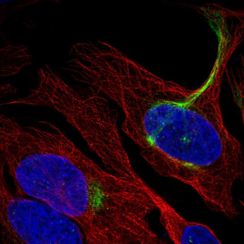Immunofluorescent staining of human cell line U-2 OS shows localization to intermediate filaments.
