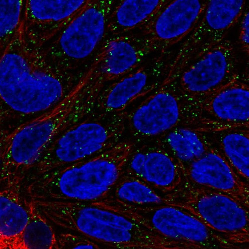 Immunofluorescent staining of human cell line RT4 shows localization to vesicles.