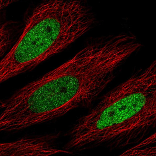 Immunofluorescent staining of human cell line SiHa shows localization to nucleoplasm.