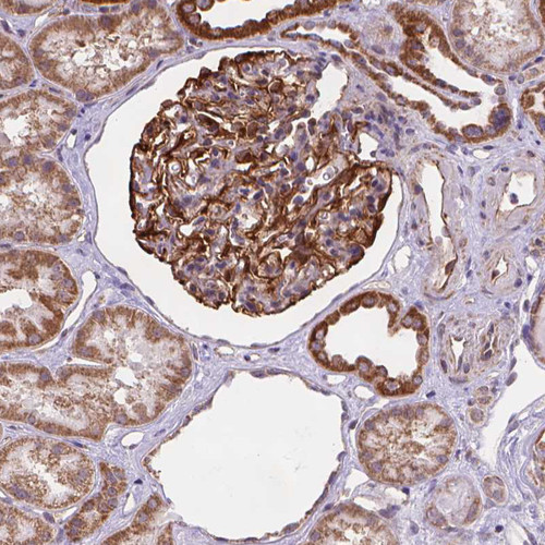 Immunohistochemical staining of human kidney shows strong cytoplasmic positivity in cells in glomeruli.