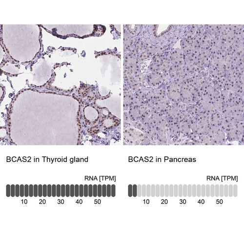 Immunohistochemistry analysis in human thyroid gland and pancreas tissues using Anti-BCAS2 antibody. Corresponding BCAS2 RNA-seq data are presented for the same tissues.