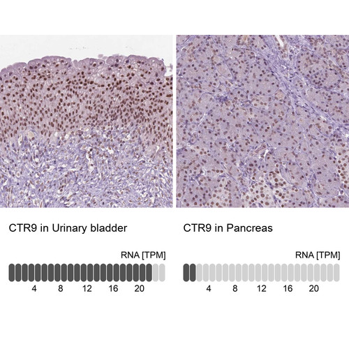 Immunohistochemistry analysis in human urinary bladder and pancreas tissues using Anti-CTR9 antibody. Corresponding CTR9 RNA-seq data are presented for the same tissues.