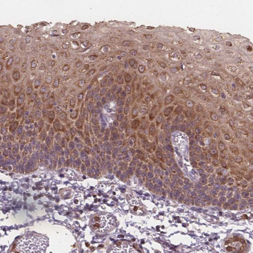 Immunohistochemical staining of human esophagus shows moderate cytoplasmic positivity in squamous epithelial cells.