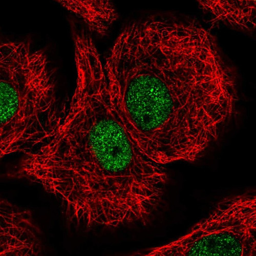 Immunofluorescent staining of human cell line A549 shows localization to nucleoplasm.
