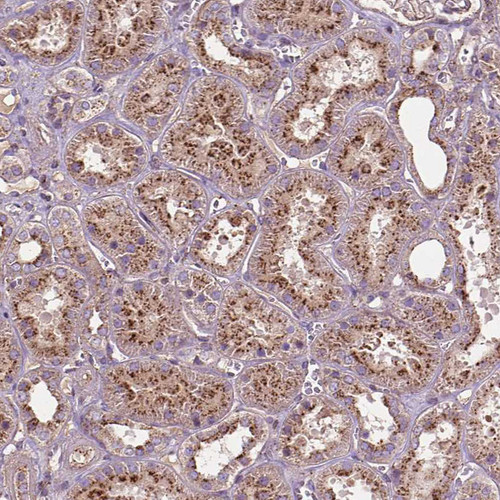 Immunohistochemical staining of human kidney shows strong granular cytoplasmic positivity in cells in tubules.