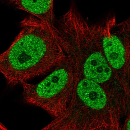 Immunofluorescent staining of human cell line SK-MEL-30 shows localization to nucleoplasm.