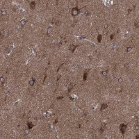 Immunohistochemical staining of human cerebral cortex shows strong cytoplasmic positivity in neuronal cells.