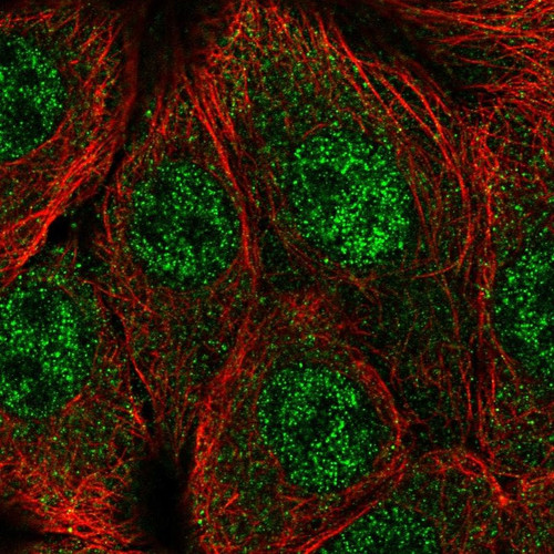 Immunofluorescent staining of human cell line MCF7 shows localization to nucleoplasm.