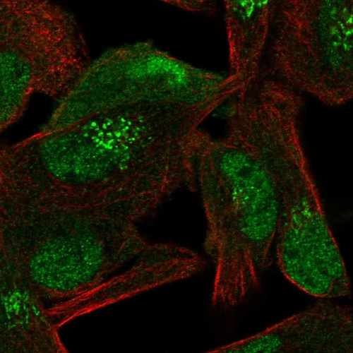 Immunofluorescent staining of human cell line RH-30 shows localization to nucleoplasm, cytosol & the Golgi apparatus.
