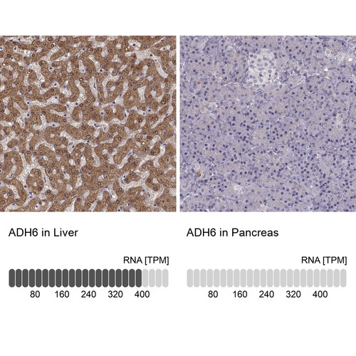 Immunohistochemistry analysis in human liver and pancreas tissues using Anti-ADH6 antibody. Corresponding ADH6 RNA-seq data are presented for the same tissues.