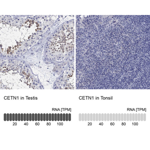 Immunohistochemistry analysis in human testis and tonsil tissues using Anti-CETN1 antibody. Corresponding CETN1 RNA-seq data are presented for the same tissues.