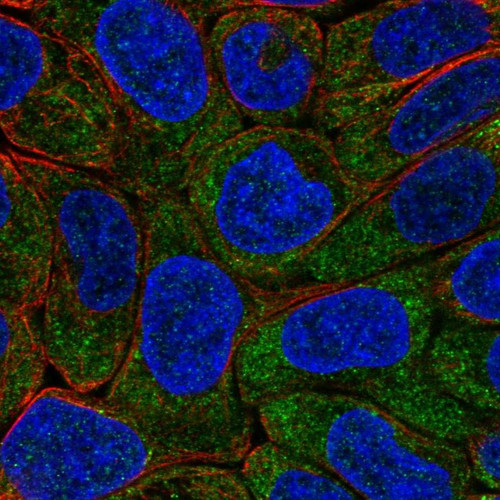 Immunofluorescent staining of human cell line RT4 shows localization to cytosol.