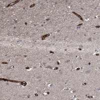 Immunohistochemical staining of human cerebral cortex shows strong cytoplasmic positivity in endothelial cells.