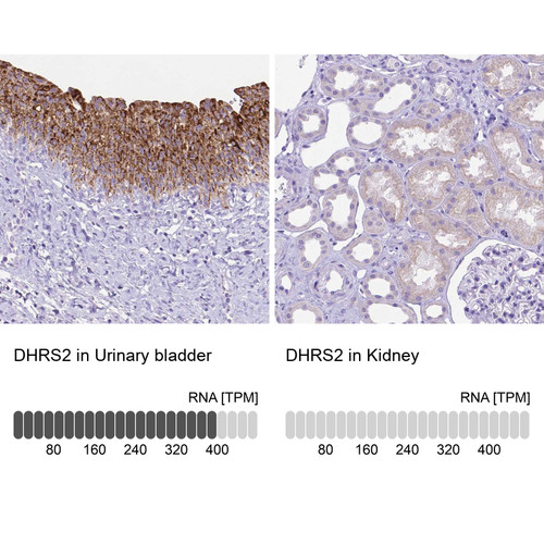 Immunohistochemistry analysis in human urinary bladder and kidney tissues using Anti-DHRS2 antibody. Corresponding DHRS2 RNA-seq data are presented for the same tissues.