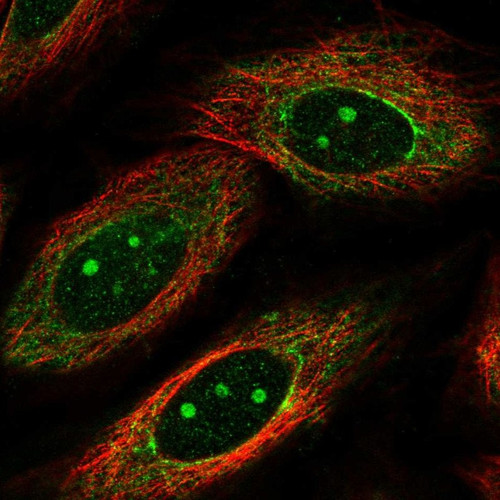 Immunofluorescent staining of human cell line SiHa shows localization to nucleoli & cytosol.