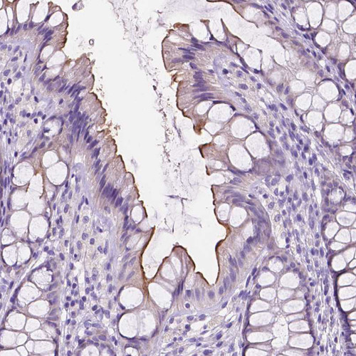 Immunohistochemical staining of human stomach shows moderate cytoplasmic positivity in glandular cells.