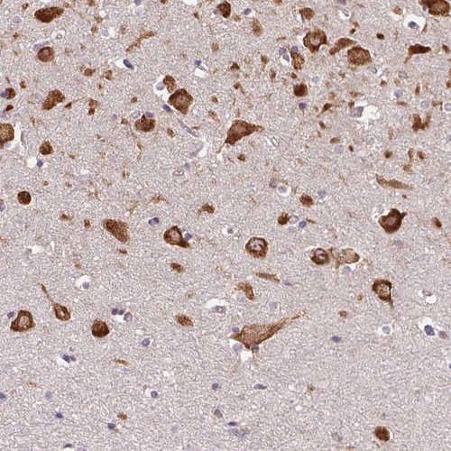 Immunohistochemical staining of human hippocampus shows cytoplasmic positivity in neurons.