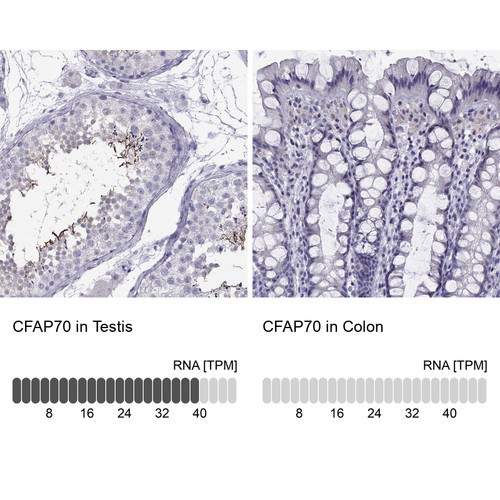 Immunohistochemistry analysis in human testis and colon tissues using Anti-CFAP70 antibody. Corresponding CFAP70 RNA-seq data are presented for the same tissues.