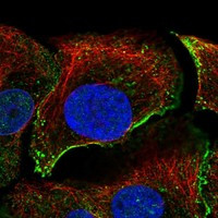 Immunofluorescent staining of human cell line HaCaT shows localization to nucleoplasm, plasma membrane & vesicles.