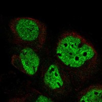 Immunofluorescent staining of human cell line A-431 shows localization to nucleoplasm.