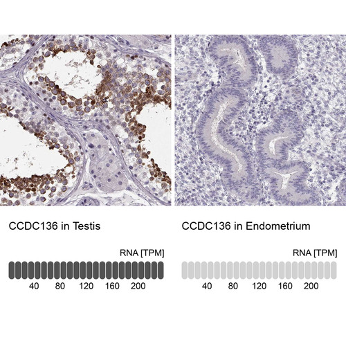 Immunohistochemistry analysis in human testis and endometrium tissues using Anti-CCDC136 antibody. Corresponding CCDC136 RNA-seq data are presented for the same tissues.