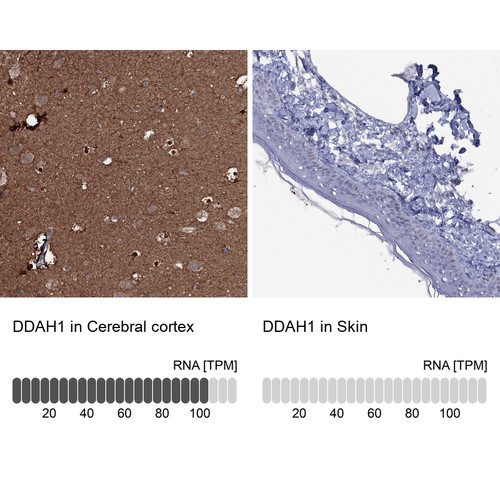 Immunohistochemistry analysis in human kidney and lymph node tissues using Anti-DDAH1 antibody. Corresponding DDAH1 RNA-seq data are presented for the same tissues.