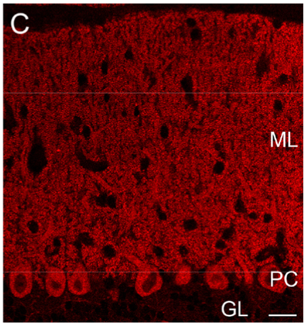 Anti VDCC (ALPHA)1G (Cav3.1) pAb