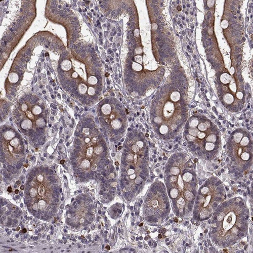 Immunohistochemical staining of human small intestine shows strong membranous positivity in glandular cells.