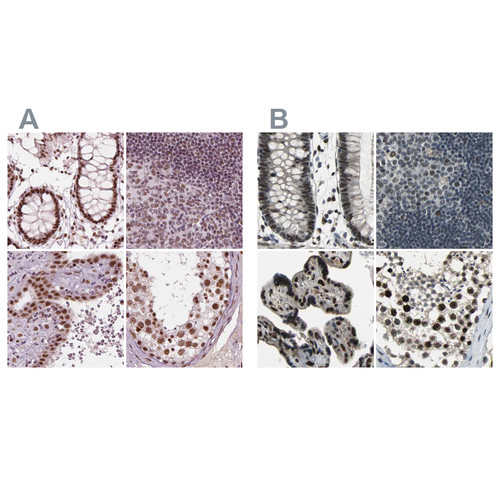 Immunohistochemical staining of human colon, lymph node, placenta and testis using Anti-ELF2 antibody HPA071166 (A) shows similar protein distribution across tissues to independent antibody HPA006057 (B).