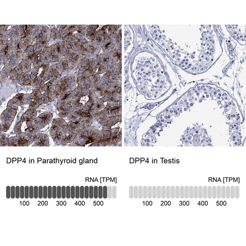 Immunohistochemistry analysis in human parathyroid gland and testis tissues using Anti-DPP4 antibody. Corresponding DPP4 RNA-seq data are presented for the same tissues.