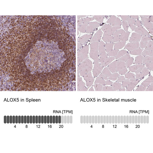 Immunohistochemistry analysis in human spleen and skeletal muscle tissues using HPA071285 antibody. Corresponding ALOX5 RNA-seq data are presented for the same tissues.
