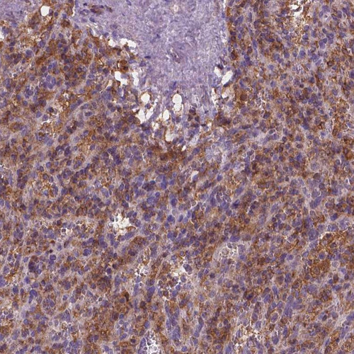 Immunohistochemical staining of human spleen shows cytoplasmic positivity in lymphoid cells.