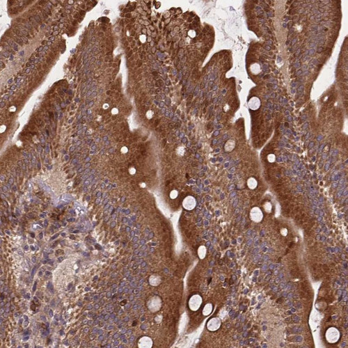 Immunohistochemical staining of human small intestine shows strong cytoplasmic positivity in glandular cells.